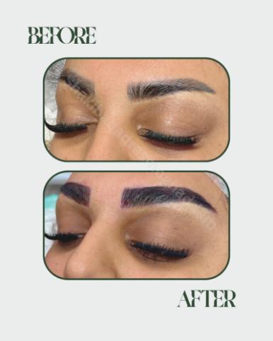 کاشت تار به تار بر روی تاتوی قدیمی