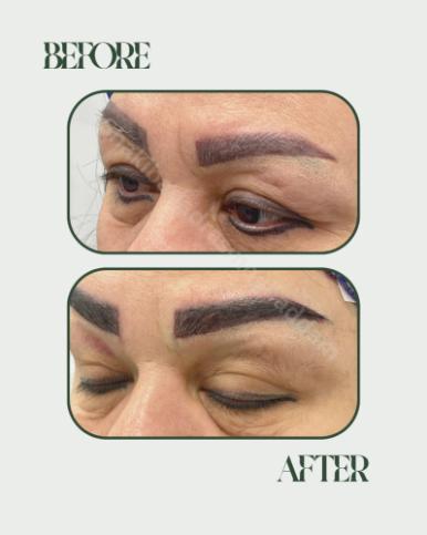 کاشت تار به تار بر روی تاتوی قدیمی و رنگ پریده